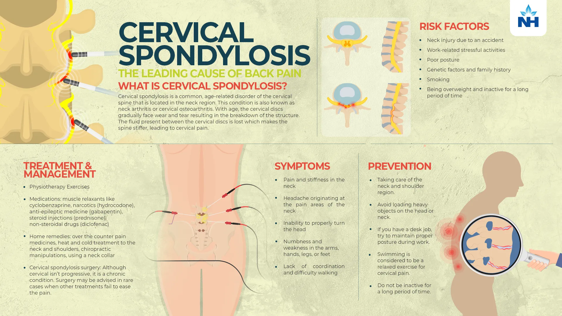 Common Medications for Cervical Pain and Their Side Effects