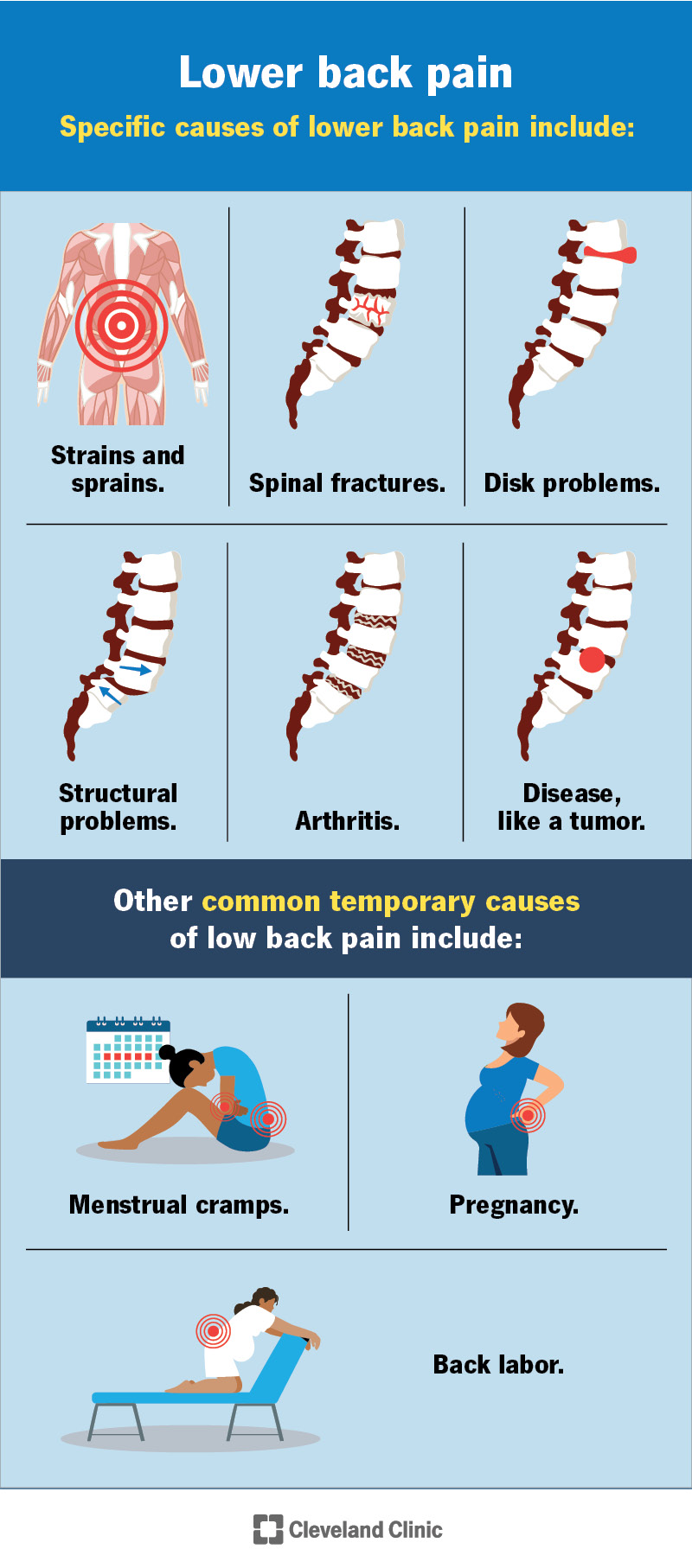 Lower Back Pain: Causes, Symptoms, and Effective Treatments