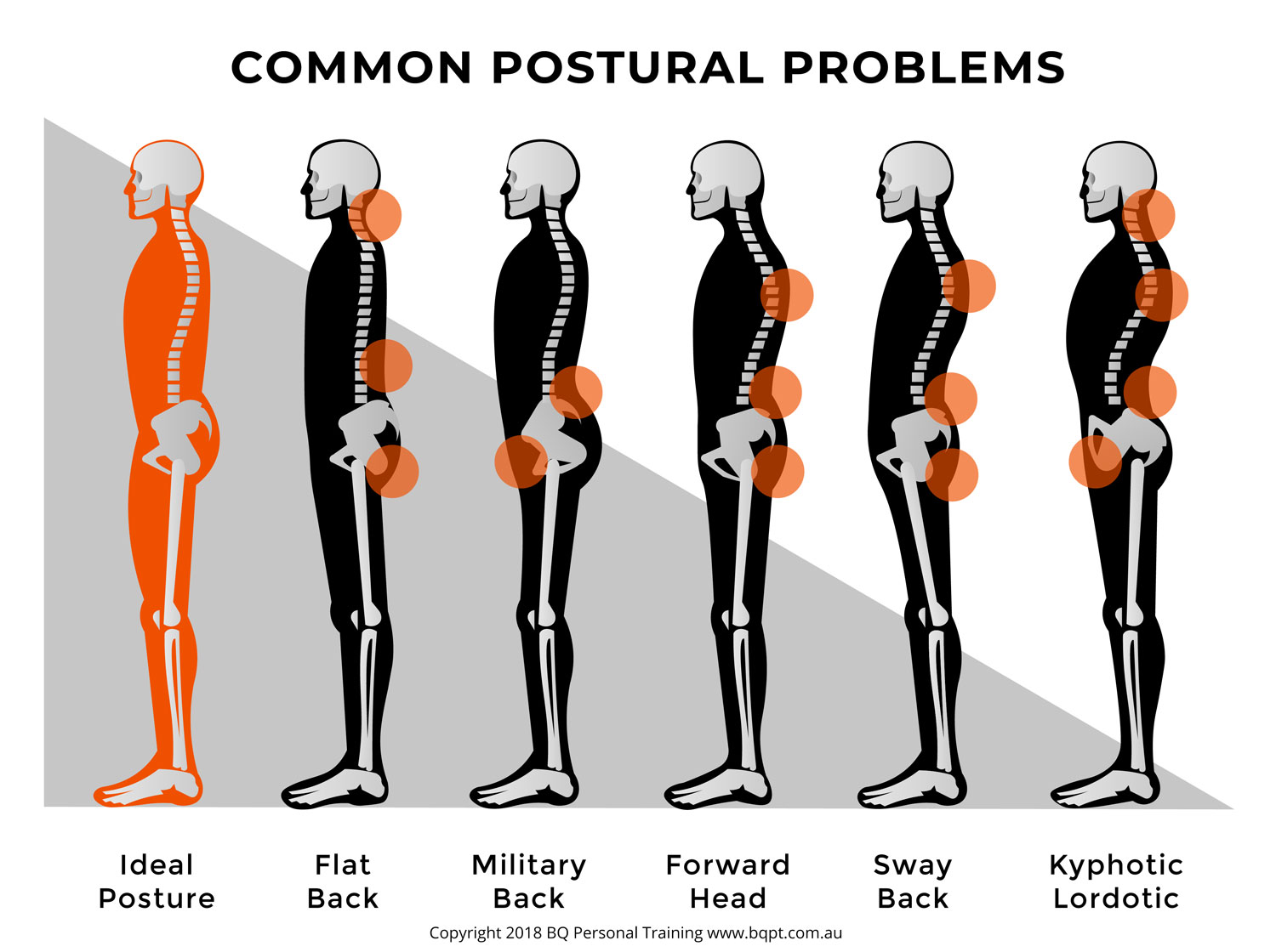 The Connection Between Poor Posture and Back Pain