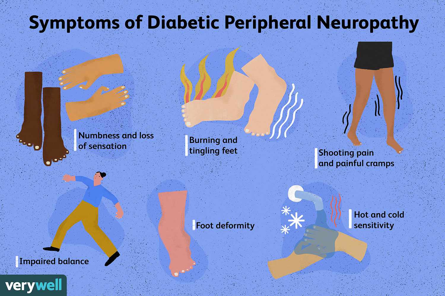 Understanding Diabetic Neuropathy: Causes, Symptoms, and Treatment Options