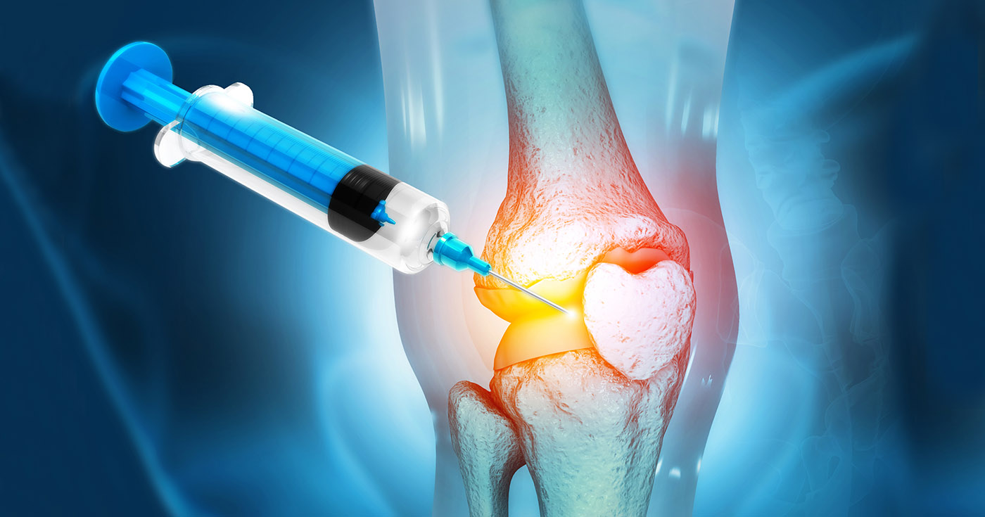 Exploring Advanced Treatments for Arthritis: Injections, Surgery, and More