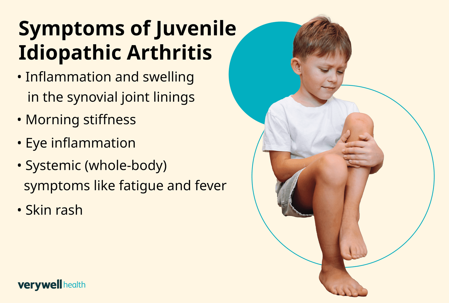 Understanding Juvenile Arthritis: Symptoms and Treatments for Kids