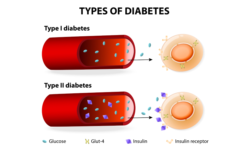 Understanding Type 1 and Type 2 Diabetes: Key Differences, Symptoms, and Management Tips