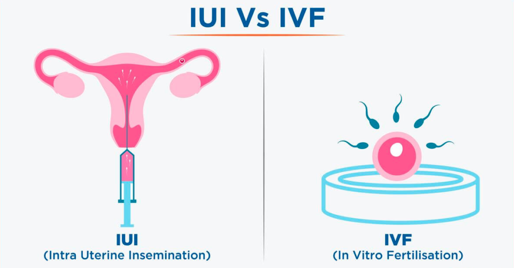 Fertility Treatments 101: A Guide to IVF, IUI, and Other Options