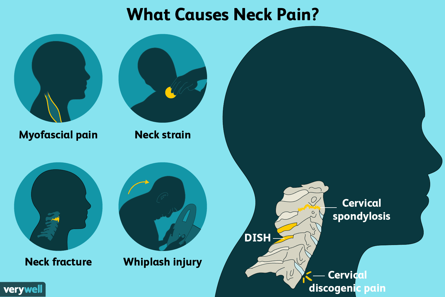 Physical Therapy for Cervical Pain: What to Expect