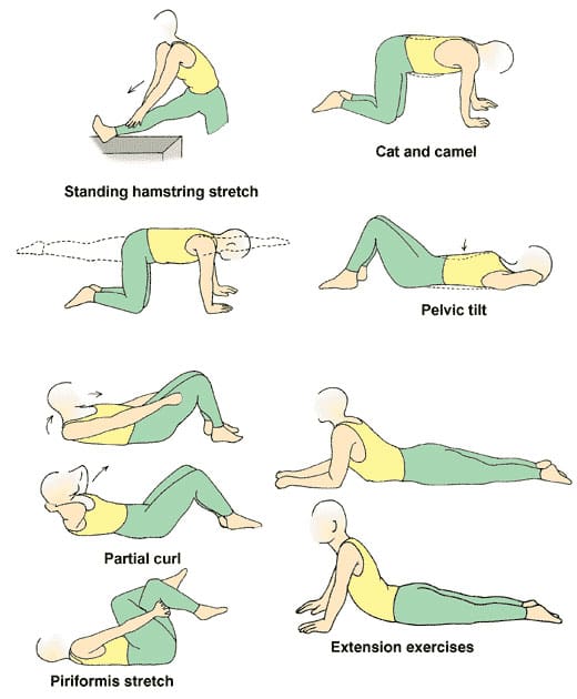 Exercises to Relieve Back Pain: Strengthening and Stretching