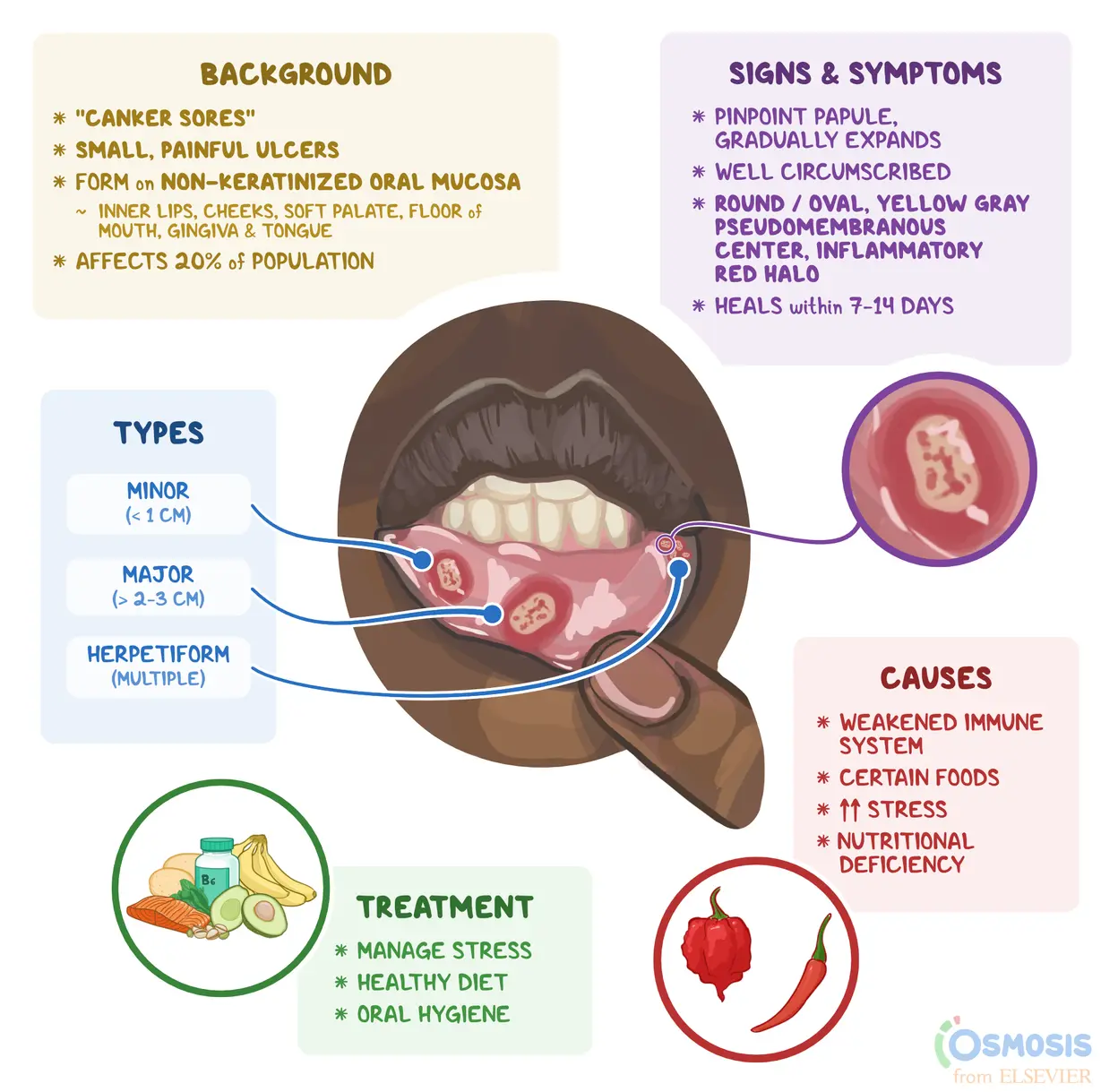 Understanding Mouth Ulcers: Causes, Symptoms, and Treatments