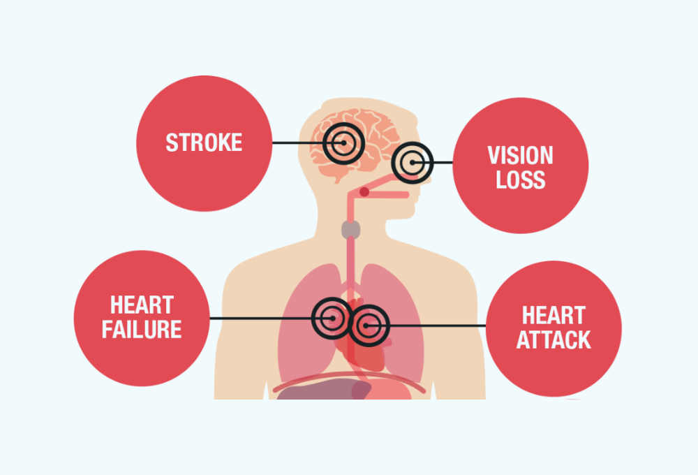 The Silent Killer: How High Blood Pressure Affects Your Heart and Health